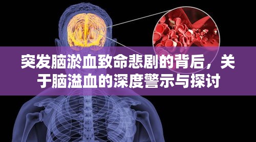 突发脑淤血致命悲剧的背后，关于脑溢血的深度警示与探讨